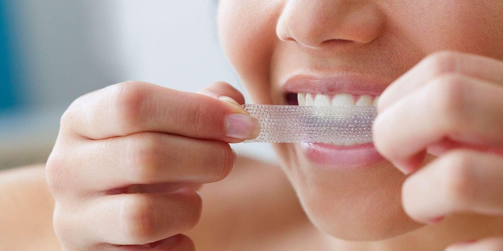 teeth whitening in Newmarket