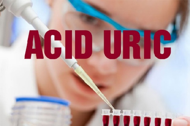 Xét nghiệm acid uric trong máu