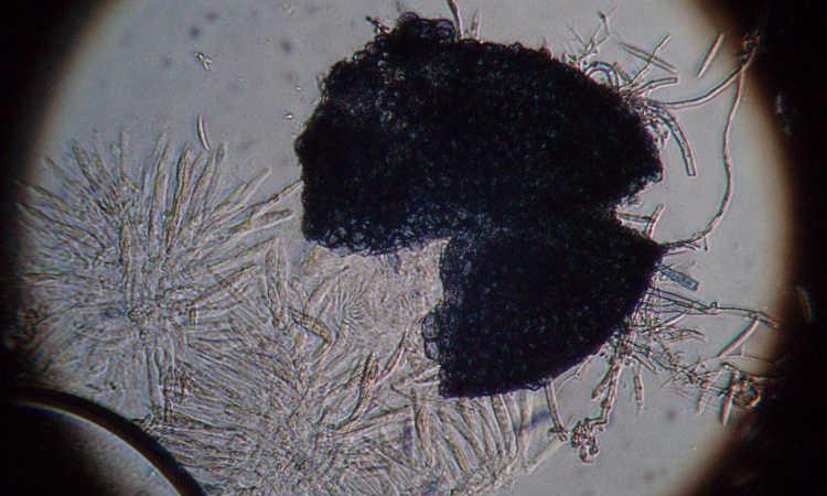 Bào tử Fusarium dưới kính hiển vi