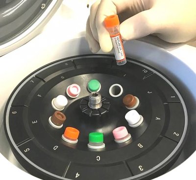 How and Why to Balance Your Centrifuge | Vetlab Supplies Ltd