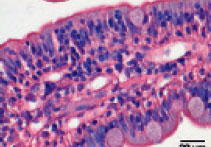 IBD in a cat: histological examination