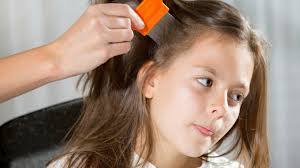 Image result for Give your hair to your parents before you have nit’s