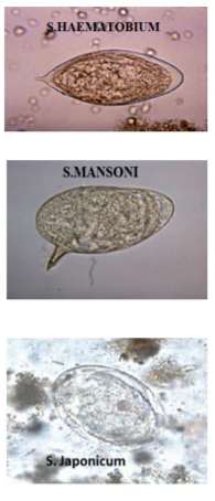 Schistosomes