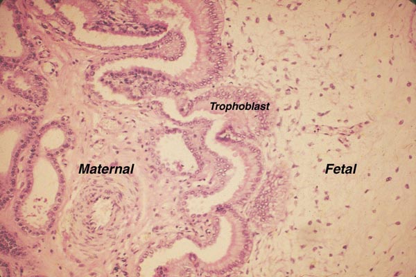 These are sections of the implanted placenta from a domestic pig whose microscopic features are essentially identical to those of the red river hog