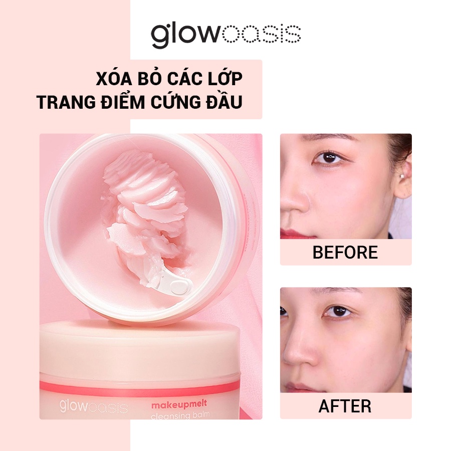 Topics tagged under skincare on Diễn đàn rao vặt hiệu quả, dang tin mua ban mien phi - Page 2 Hum7XxlBPtXj0eiv0btzQeI__PMtM2yHehD_X-BcgxUgtDVP3wcOlliTwFEGHPHO9UoFscGhfiEqAcFweVUhnX1W_mNaF8yIXYq1TmAPGUWMSM5Eqm7KfwYrX7amQZYIacunkG8Y=s0