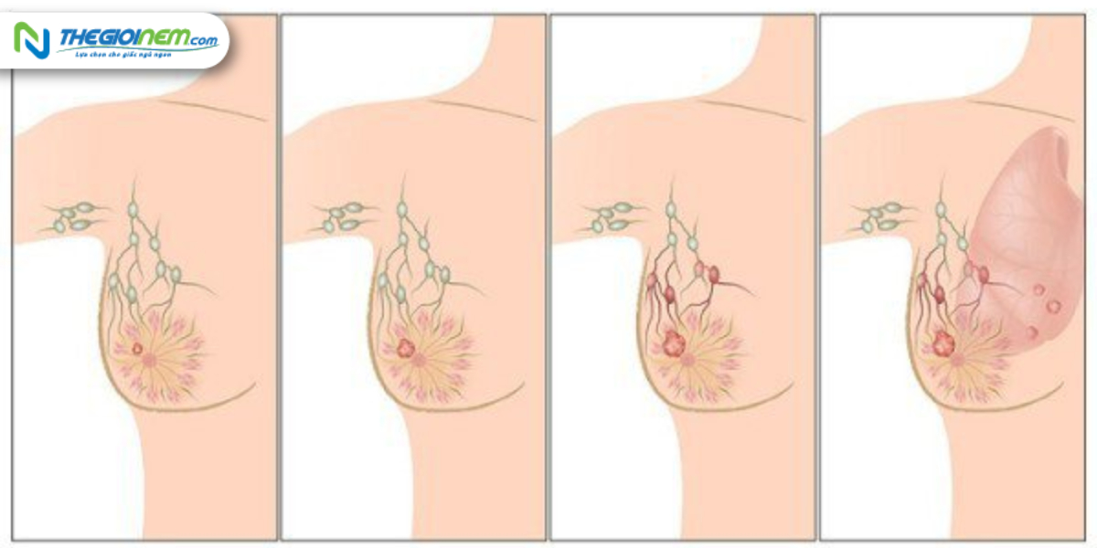 Bạn sẽ như thế nào khi bị chẩn đoán mắc căn bệnh ung thư vú