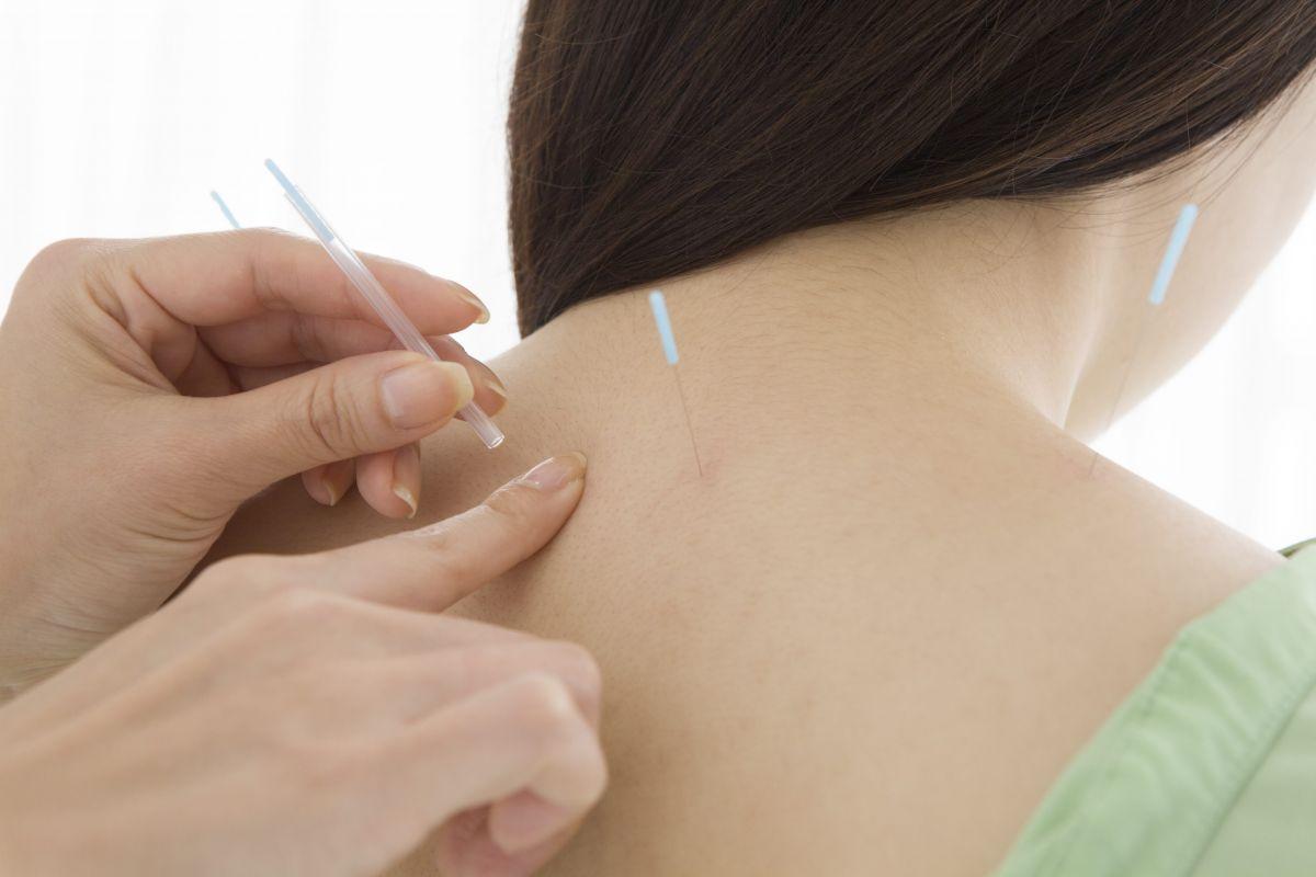 acupuncture in Richmond Hill