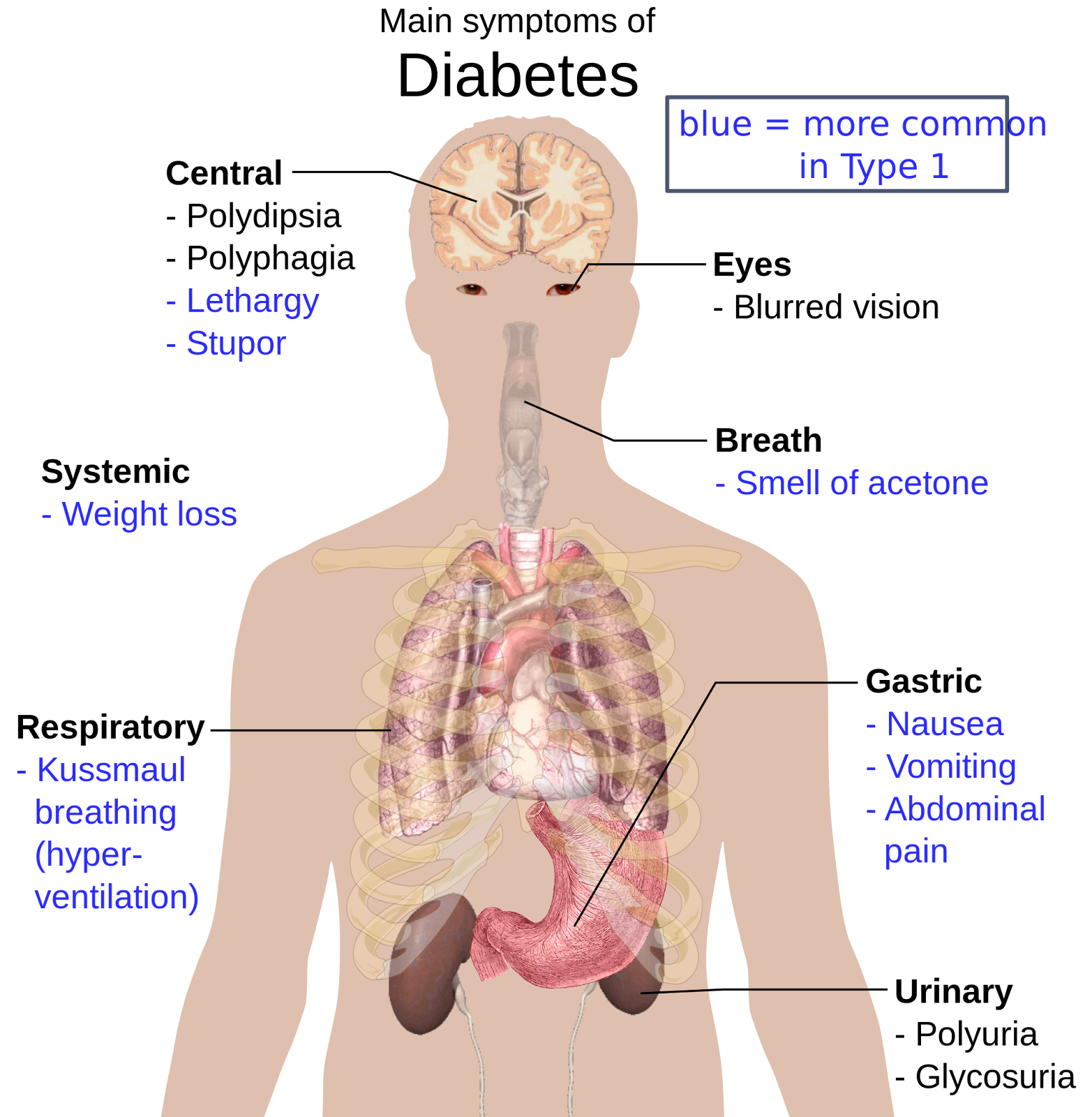 2000px-Main_symptoms_of_diabetes.svg.png