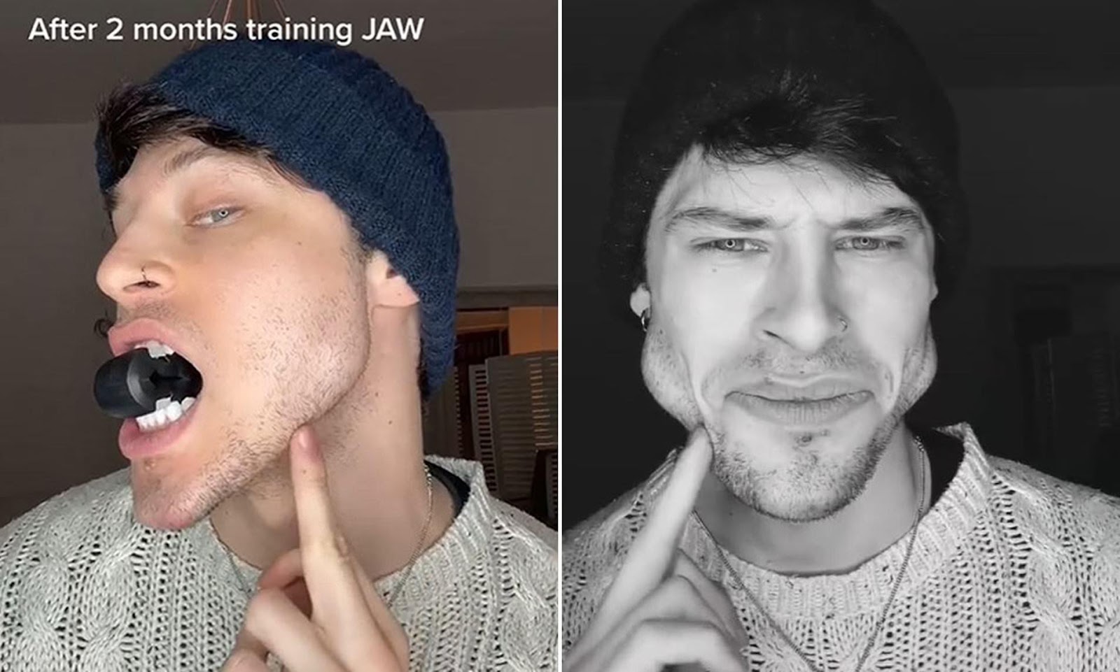 Male model reveals VERY dramatic face transformation after 'training his jaw'  for months | Daily Mail Online