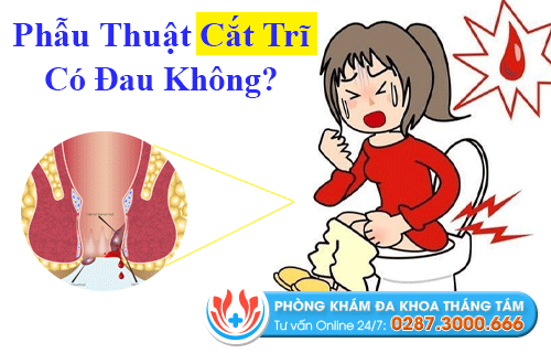 Cắt trĩ có đau không