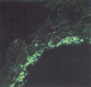 Inmunofluorescencia de virus de moquillo en secciones congeladas de pulmon canino.