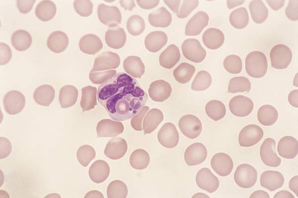 Canine eosinophils. Granules in canine eosinophils are round and can vary in size and number. This eosinophil contains a few large round granules. In this cell, the granules appear similar in size and color to the surrounding RBCs (100x). 