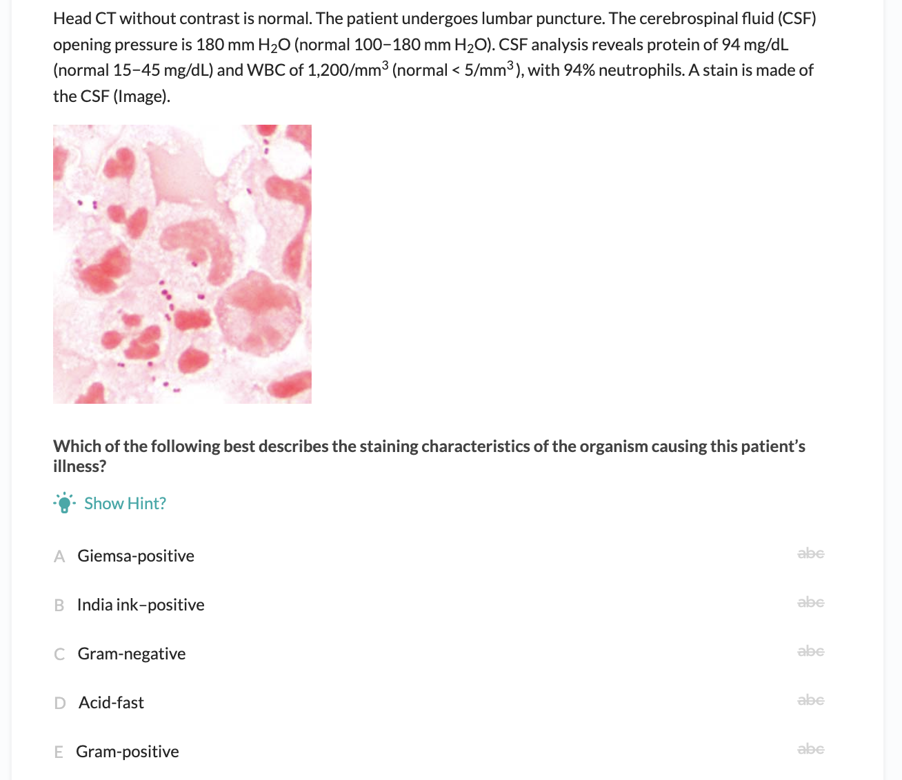 medical student qbank+ step one question from the microbiology section