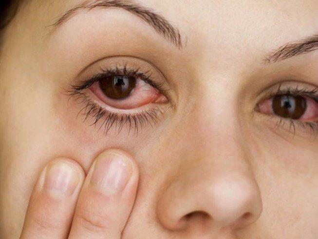 Bệnh võng mạc là bệnh gì? Có những loại nào thường gặp? | Vinmec