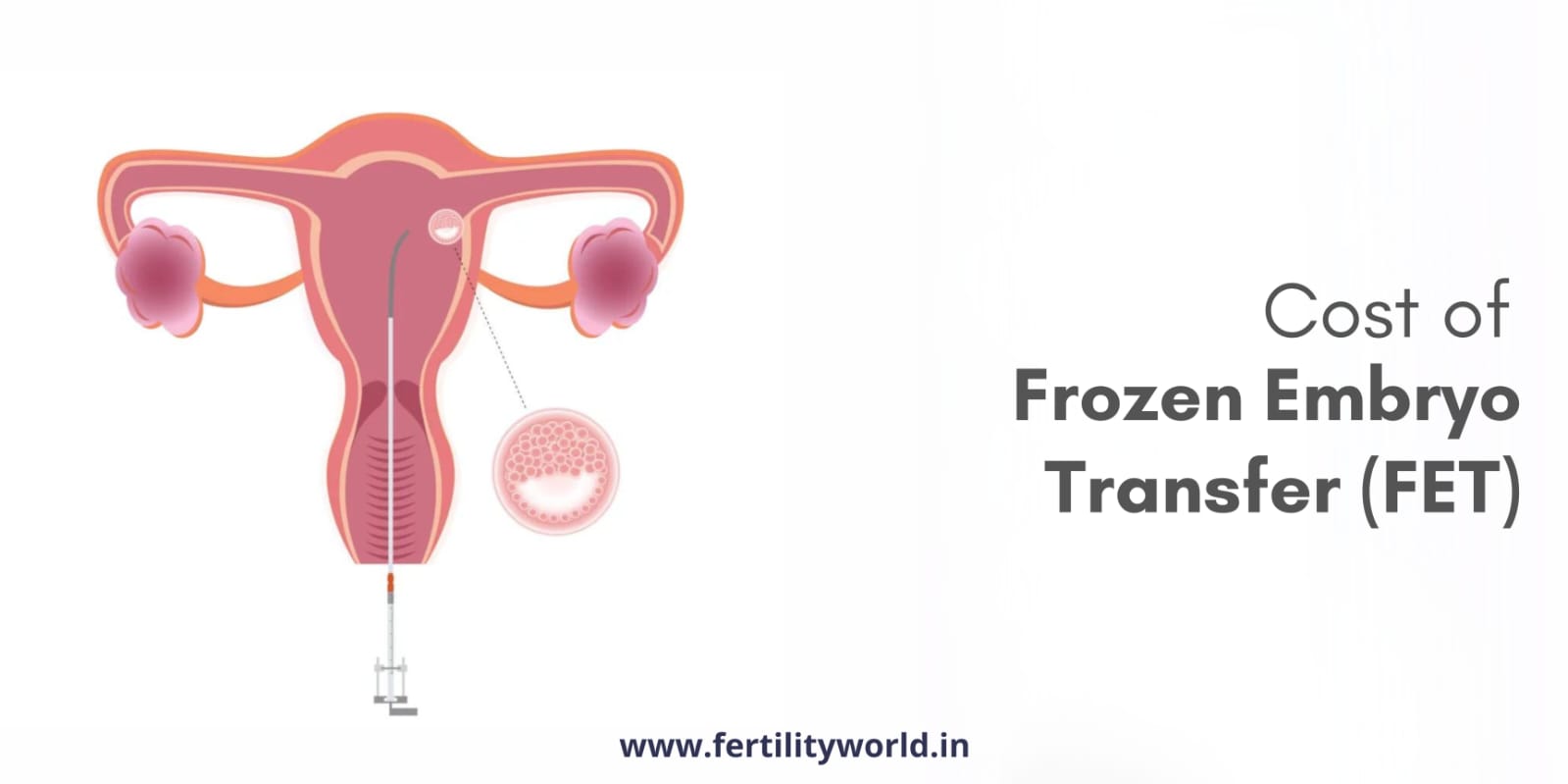 Cost of Frozen Embryo Transfer (FET) in Bangalore
