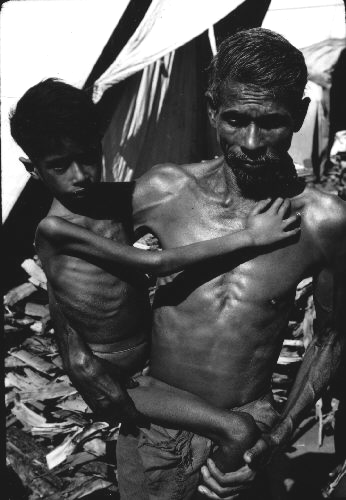  MALNOURISHED INDIA