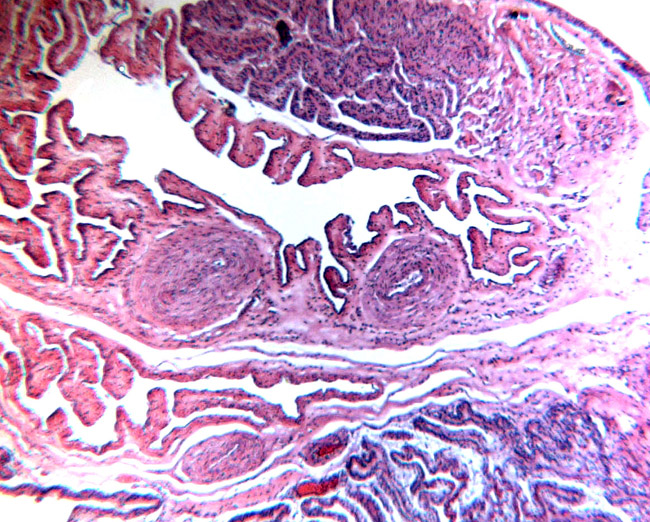 Surface with allantochorionic vessels, amnion and allantois