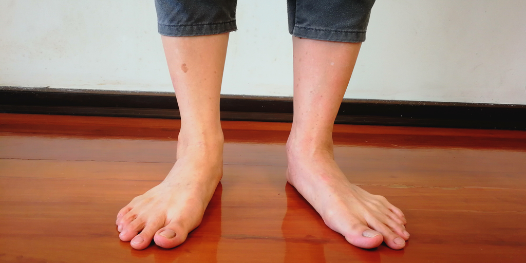 What is Pronation? Understanding Your Feet | Kintec: Footwear + Orthotics