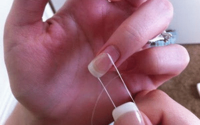 Using Dental Floss to Remove Nails