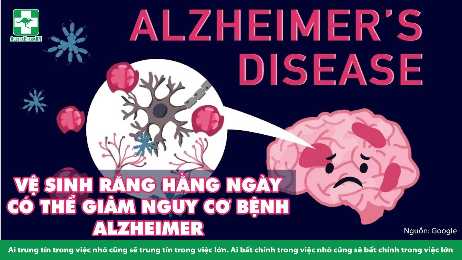 VỆ SINH RĂNG HẰNG NGÀY CÓ THỂ GIẢM NGUY CƠ BỆNH ALZHEIMER