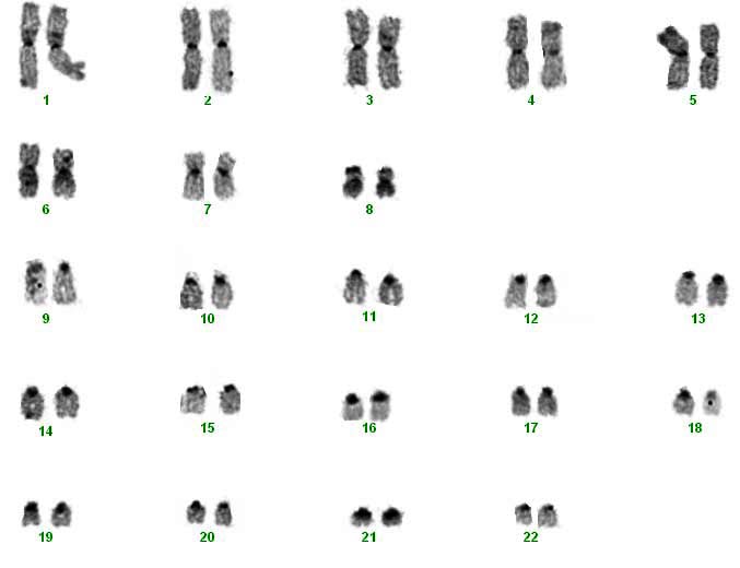 Female pocket mouse karyotype of dam used in this study. The sex chromosomes are no defined. C-banding.