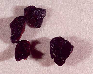A collection of dried solidified blood uroliths from the bladder of a cat