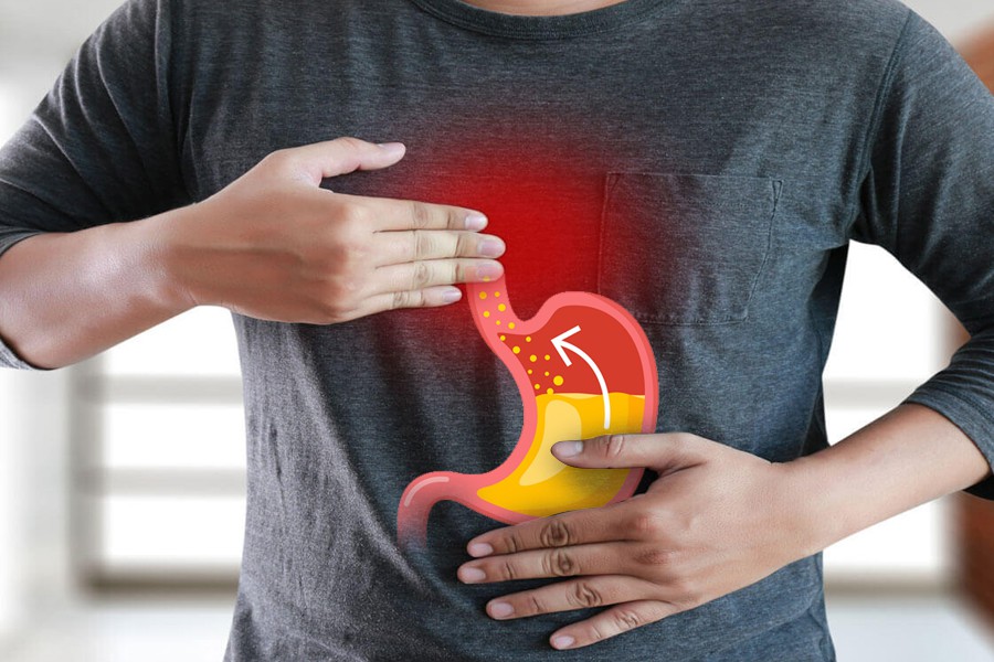 LÝ DO NƯỚC ĐIỆN GIẢI CÓ THỂ HỖ TRỢ TỐT CHO BỆNH NHÂN TRÀO NGƯỢC DẠ DÀY
