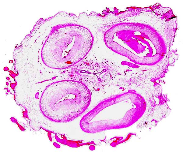 Cross section of umbilical cord with central allantoic duct