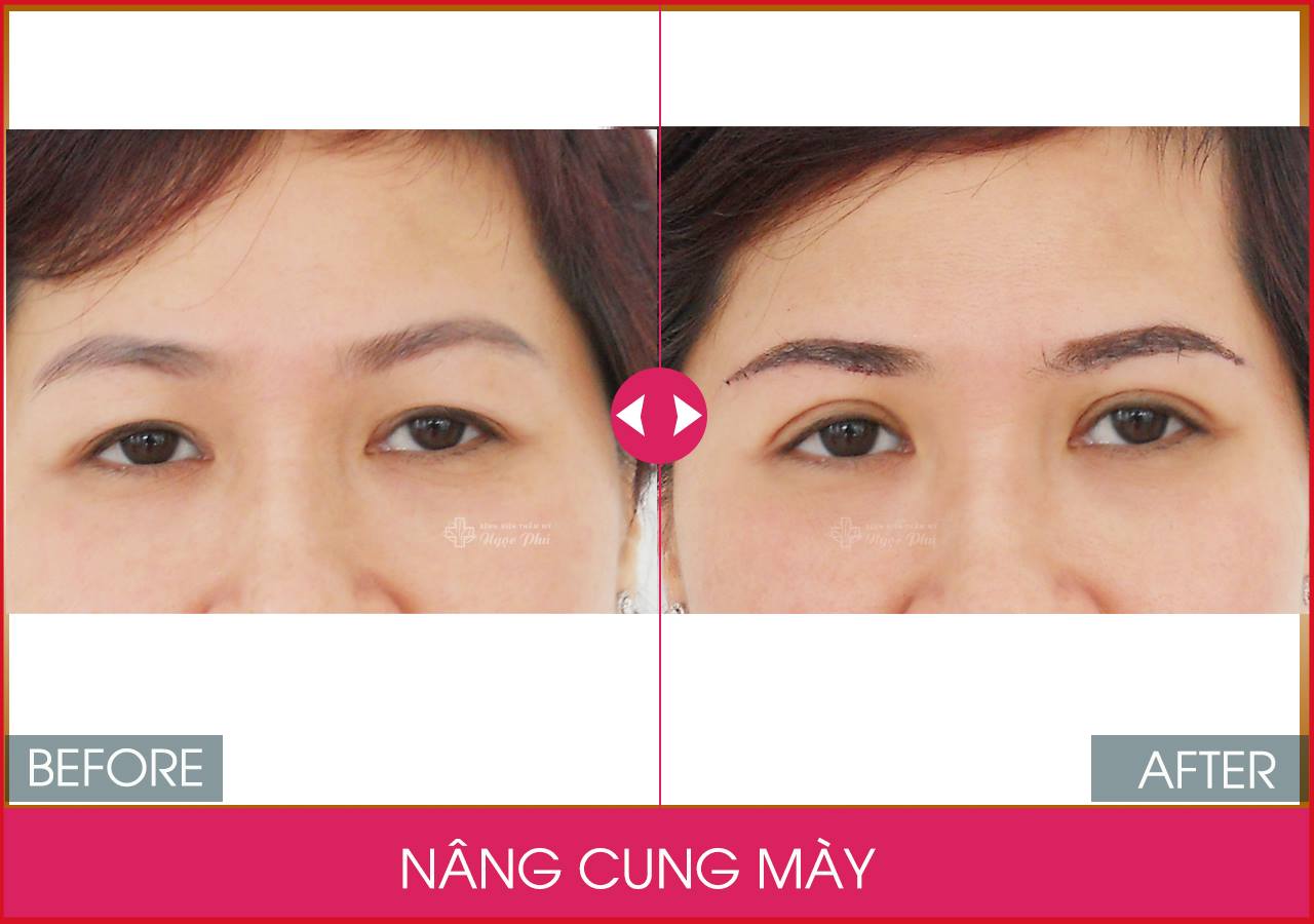 Nếu vẫn chưa biết làm phẫu thuật ở đâu thì Thẩm Mỹ Việt Nam là sự lựa chọn mà khách hàng không nên bỏ qua.