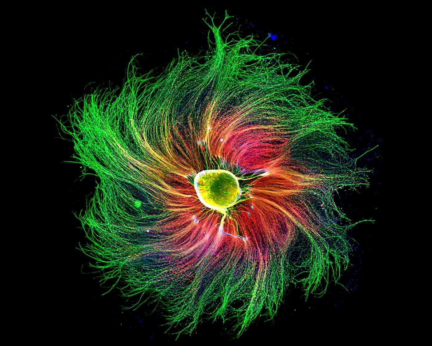 cluster of nerve cells from a rat embryo. The major structural component of the cells, the outside of the whirl, is green. The supporting structure is red. The nuclei are blue.