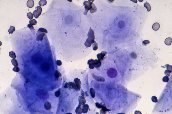 Photomicrograph of a vaginal smear collected during early estrus, containing an increased numbers of epithelial cells, all of which are "superficial" cells with either no nuclei, faint nuclei, or dense but pycnotic and small nuclei