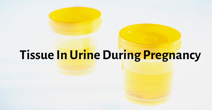 tissue in urine during pregnancy