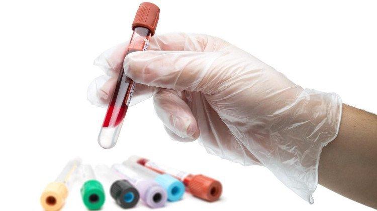 Xét nghiệm máu có thể cho biết nguy cơ mắc những bệnh gì? | Vinmec