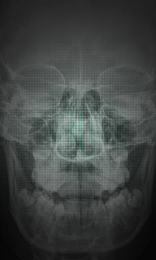 X-Ray Scanner Free apk