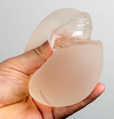 Hot New Gummy Bear Breast Implants