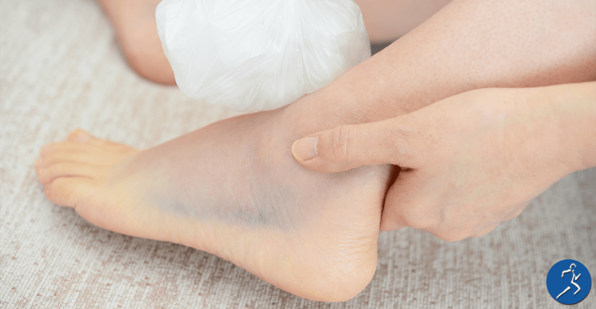 ankle-sprain-symptoms