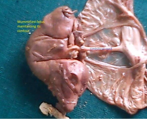 Feto de búfalo momificado recuperado manualmente de la vagina. (Foto cortesía del Dr. Sanjay Purohit, Editor, Ruminant Science, Mathura, UP, India).