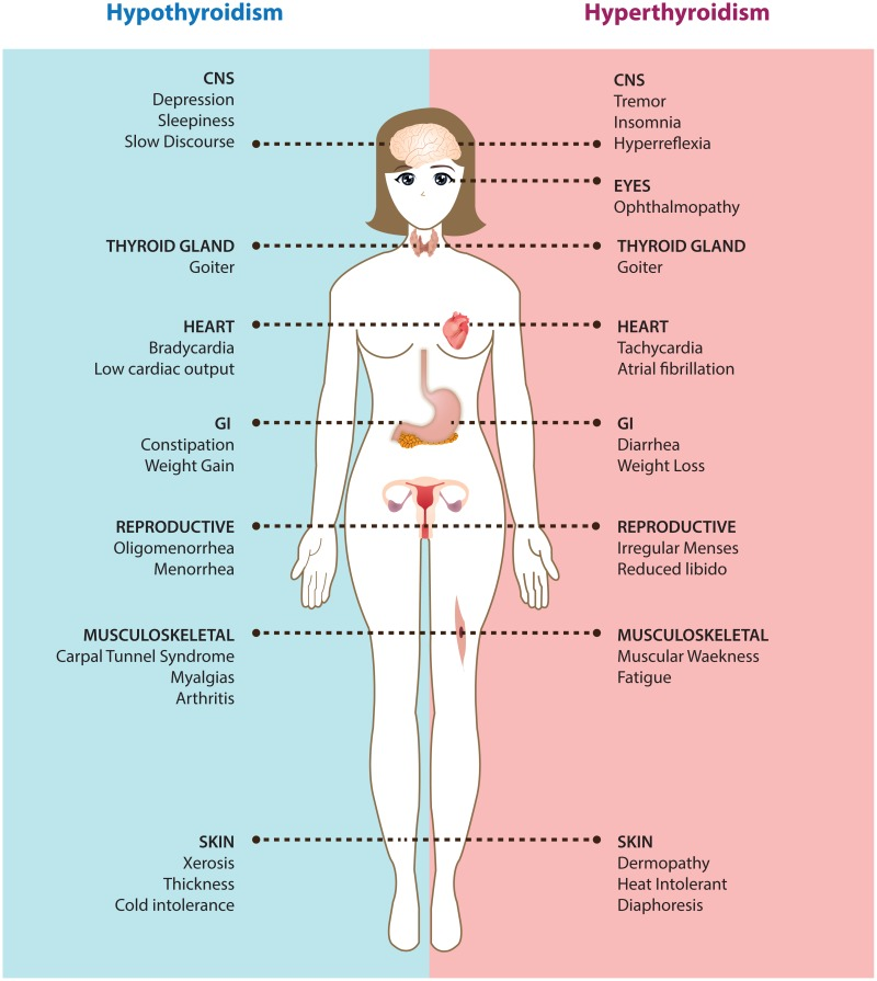 Symptoms of hypothyroidism and hyperthyroidism