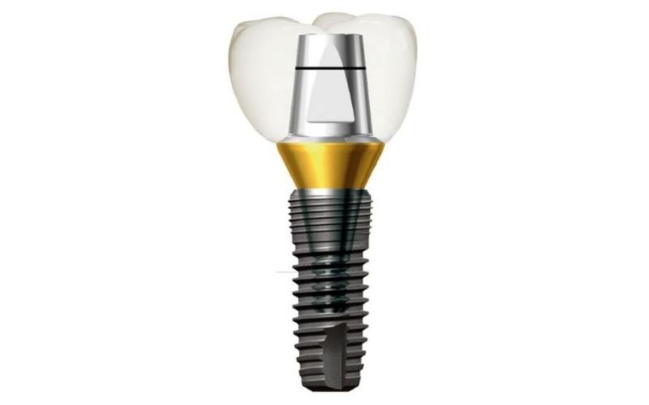 Implant Dentium Superline nằm trong top 10 dòng trụ tốt nhất