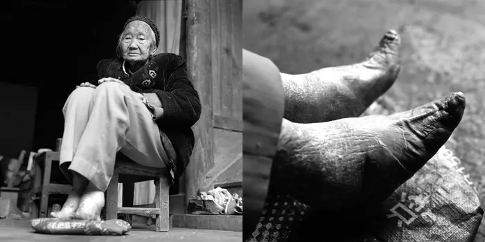 Foot Binding Practice