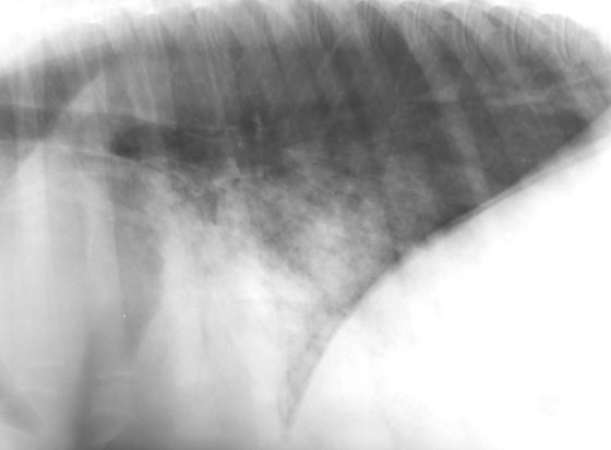 A left lateral radiograph of the thorax of a young horse with aspiration pneumonia The accessory lung lobe and the dependent segments of the middle lung lobes are opacified and contain air bronchogram signs. Cranial ventral lung segments are not affected.
