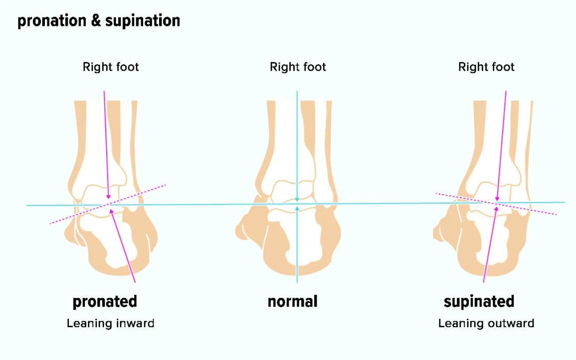 running shoes pronation supination gait