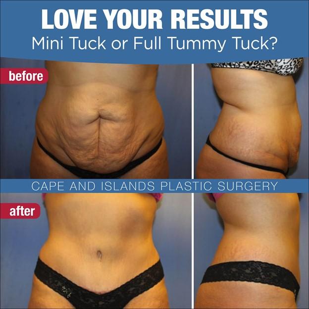 A collage of a person's chest and chest

Description automatically generated with low confidence