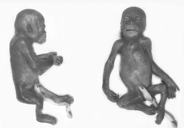 Deciduitis and chorioamnionitis in the membranes of a prematurely delivered orangutan fetus