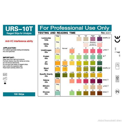 Urinalysis Test Color Chart