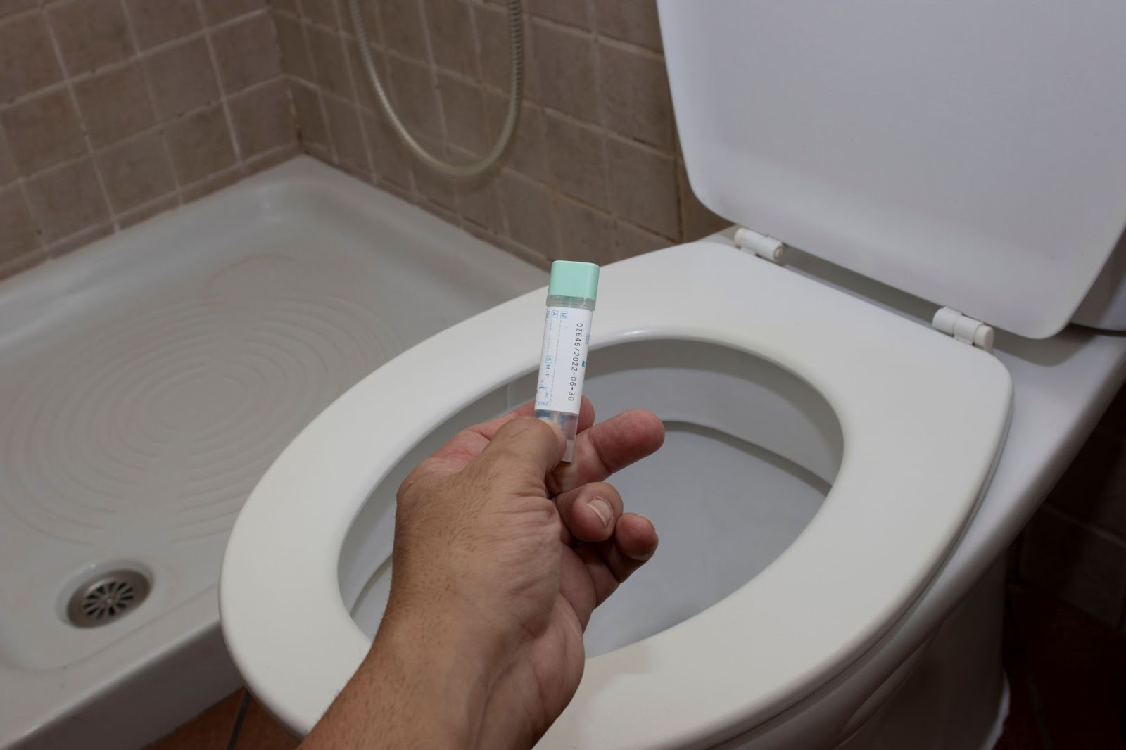 Do You Need A Prescription For an At Home Colon Cancer Tests