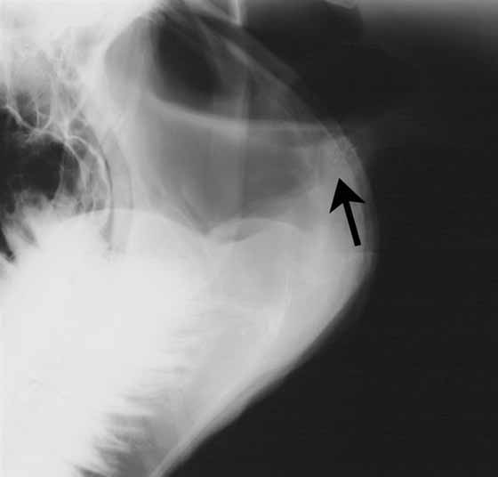 An abnormal area of arytenoid calcification is visible (arrow) on this lateral radiograph of the larynx of a horse with chondritis.