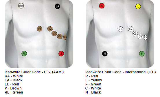 ViSi Mobile Smart Tip - Performing an EKG