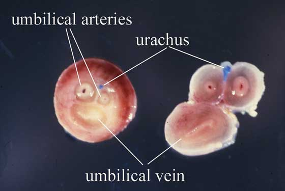  The umbilical cord is relatively long in the horse and is divided into an amniotic and allantoic segment by the attachment of the amnion.