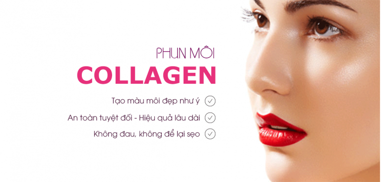 phun môi collagen có sưng không